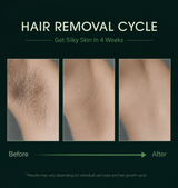 SmoothGlow — Depilador IPL de Luz Pulsada